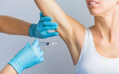 Excessive sweating and Botox treatments