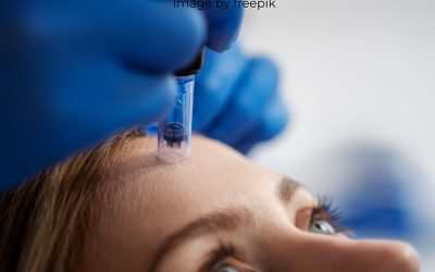 SkinPen Microneedling in Surrey: Why It’s the Gold Standard for Microneedling