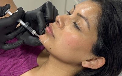 How Long Do Anti-Wrinkle Injections Last?