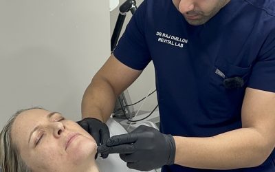 Dermal Fillers for Facial Lifting and contouring: What Areas Can Be Treated?