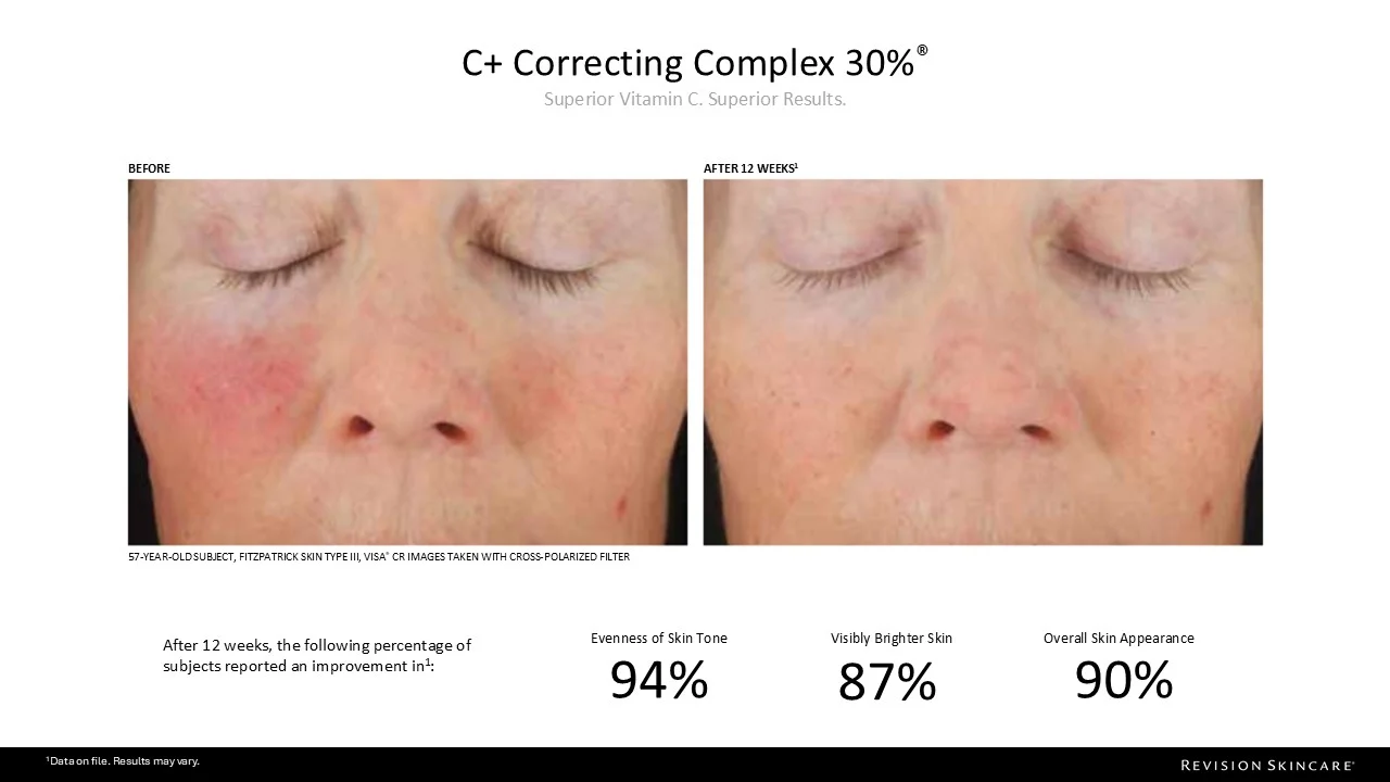 C+ Correcting Complex 30%™ - Image 3