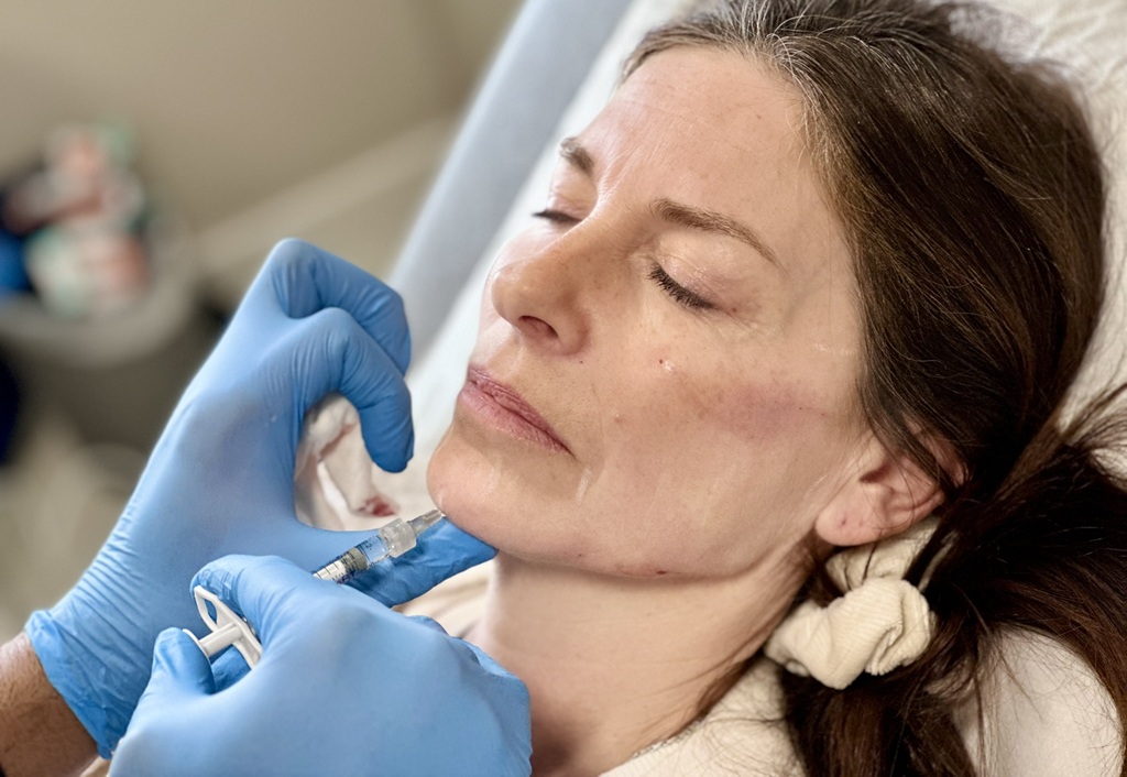 Crepey Skin & Skin Laxity Treatments in Esher, Surrey