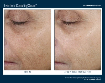 Even Tone Correcting Serum™ - Image 2
